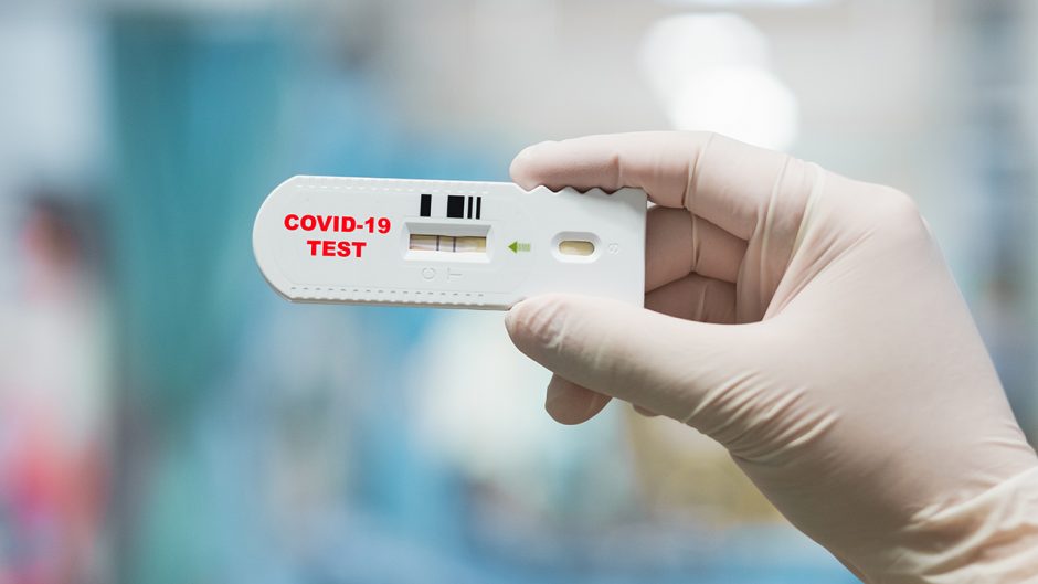 Doctor hand holding positive Coronavirus or Covid-19 rapid test