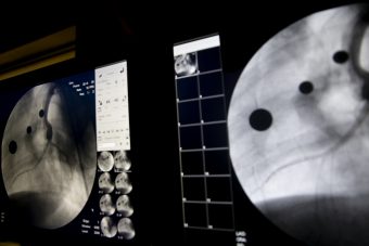 screen showing medical images