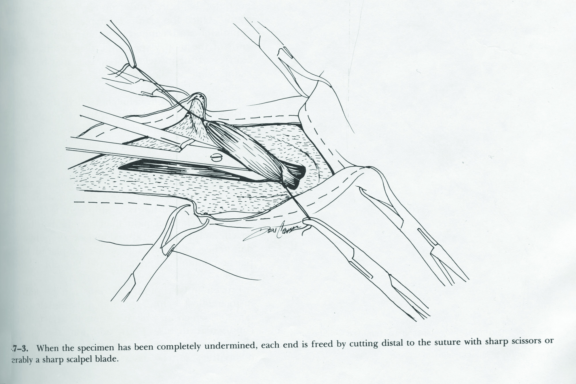 an illustration by don connor that appeared in a medical textbook.