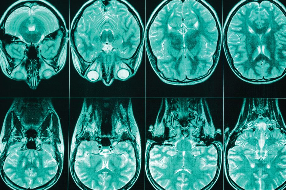 brain medical imaging