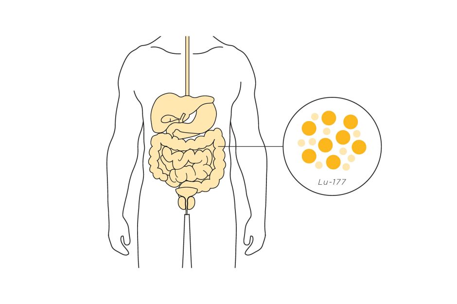 Graphic of midsection showing gastrointestinal tract and pancreas with inset of Lutetium-177 isotope.