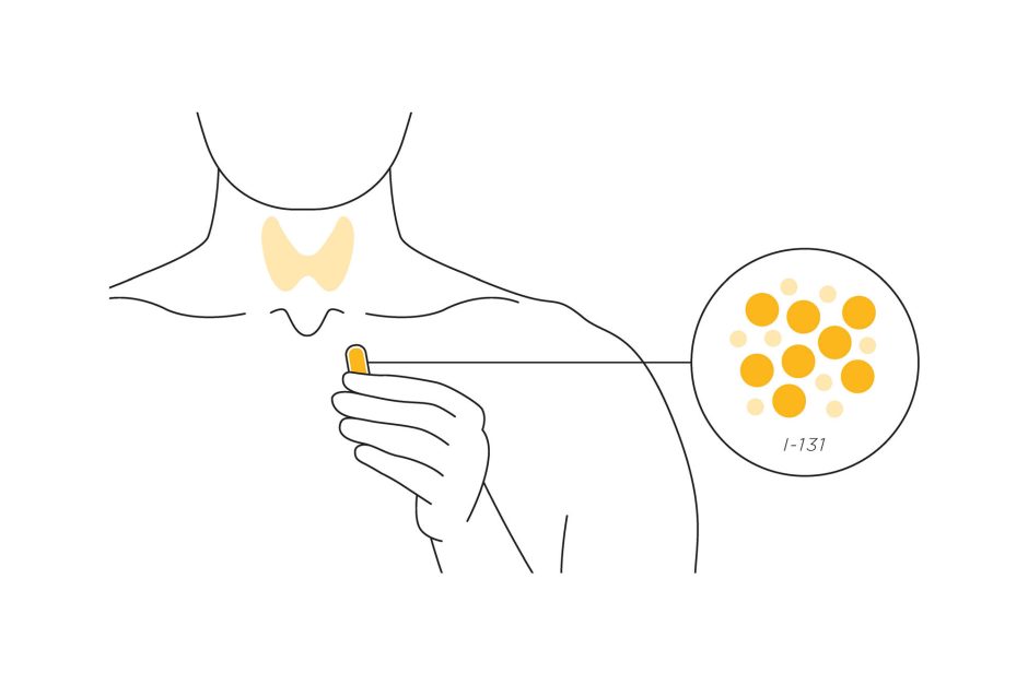 Graphic of hand with pill, showing targeted area of throat and an inset of sodium iodide isotope.