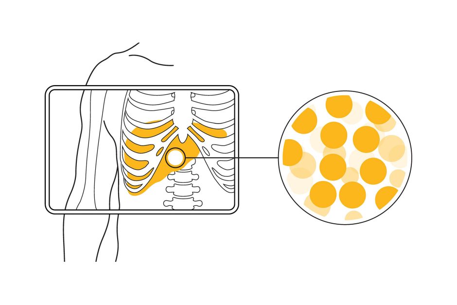 Graphic of ribcage and liver with inset of isotopes used to make radiopharmaceuticals.