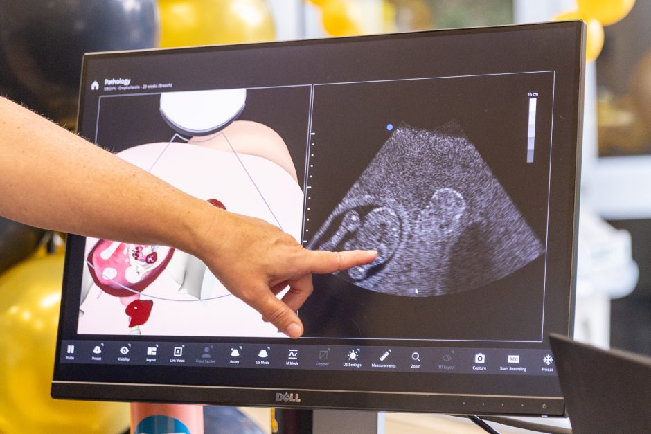 Hand points at medical imaging on a computer screen