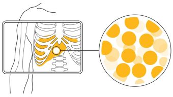 Diagram of EyE90 microspheres