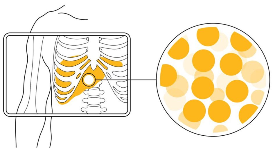 Diagram of EyE90 microspheres